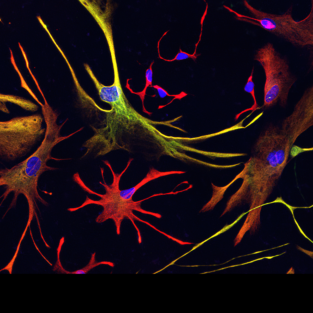 Colorful microglia with protrusions extending towards each other