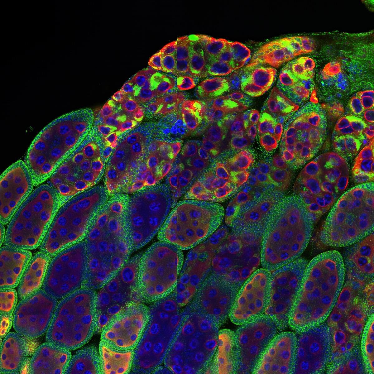 Micrograph of an ovary: spherical shape with cells inside