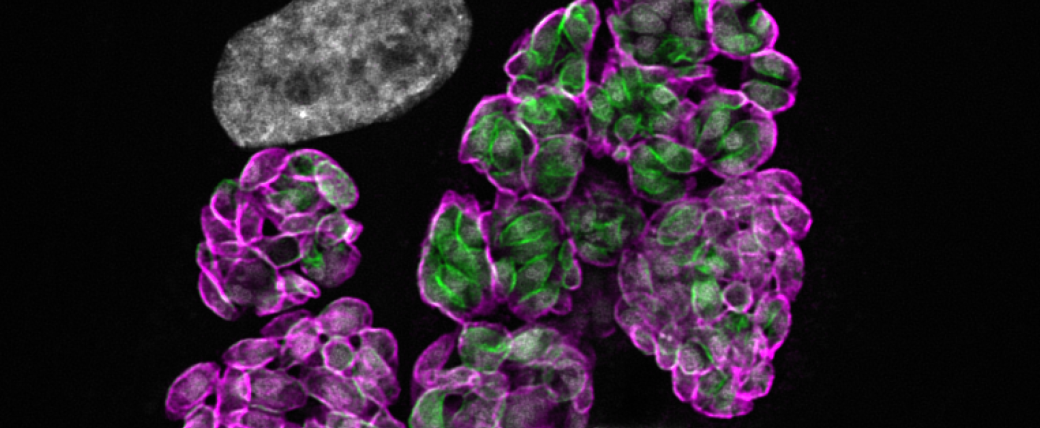 An oval grey shape in the top right, and near it big clusters of many closely connected parasite cells with green centers and magenta membranes. Some membranes contain many green shapes.