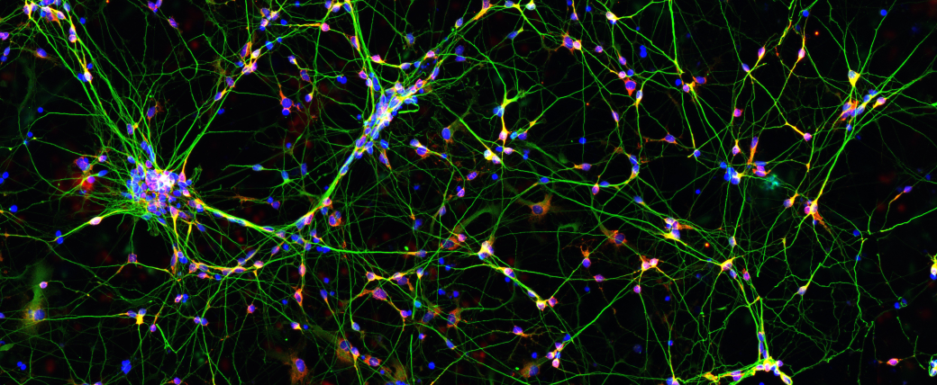 A criss-crossing, 3D network of neurons, with many wiry green axons connecting many blue nucleii