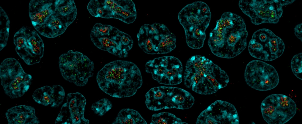 Images of cells in cyan, with one or a few organelles visible in each, with red and green dots inside.