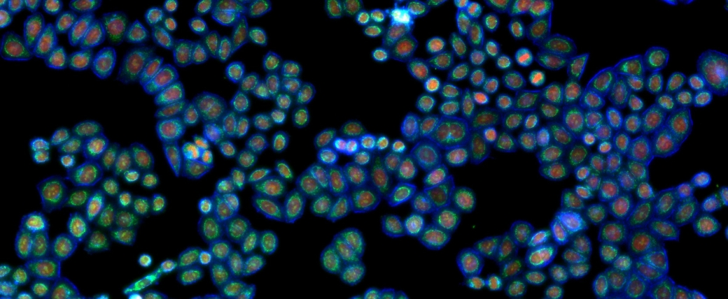 Many small oval cells in clusters against a black background, with blue perimeters and red and green inside