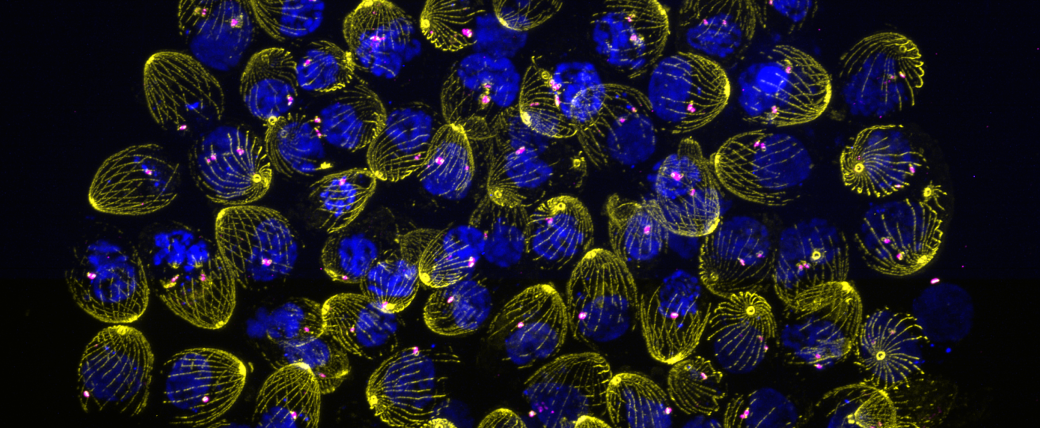 Micrpgraph: Cluster of many egg-shaped items, with a spiral yellow outer skeletal structure, blue interior and spots of purple