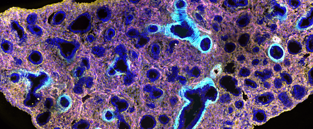 Slice of tissue mostly purple with holes ringed in blue, and some yellow around the edges