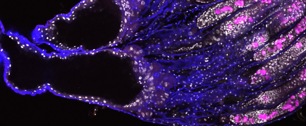 A deflated balloon sort of shape, mostly hollow on the left, with fingerlike shapes inside the "balloon" head to the right, which turn from dark purple to bright pink going father right. Small white dots are scattered throughout.