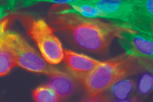 Micrograph of cells with nuclei stained