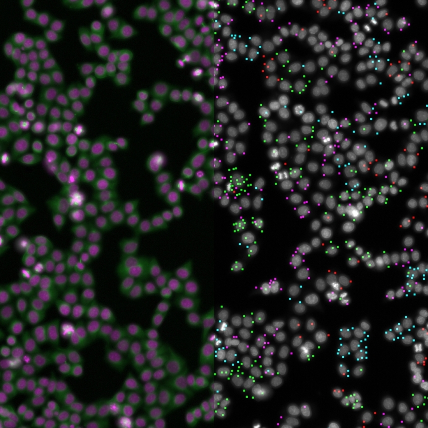Left: stained cells, some with visible defects. Right: cells with color coded dots around them. 