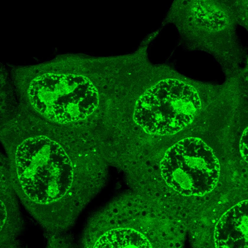 Cells in green with bright green subcompartments