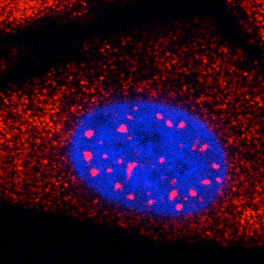 Cells with a blue nucleus, with large red dots in the nucleus