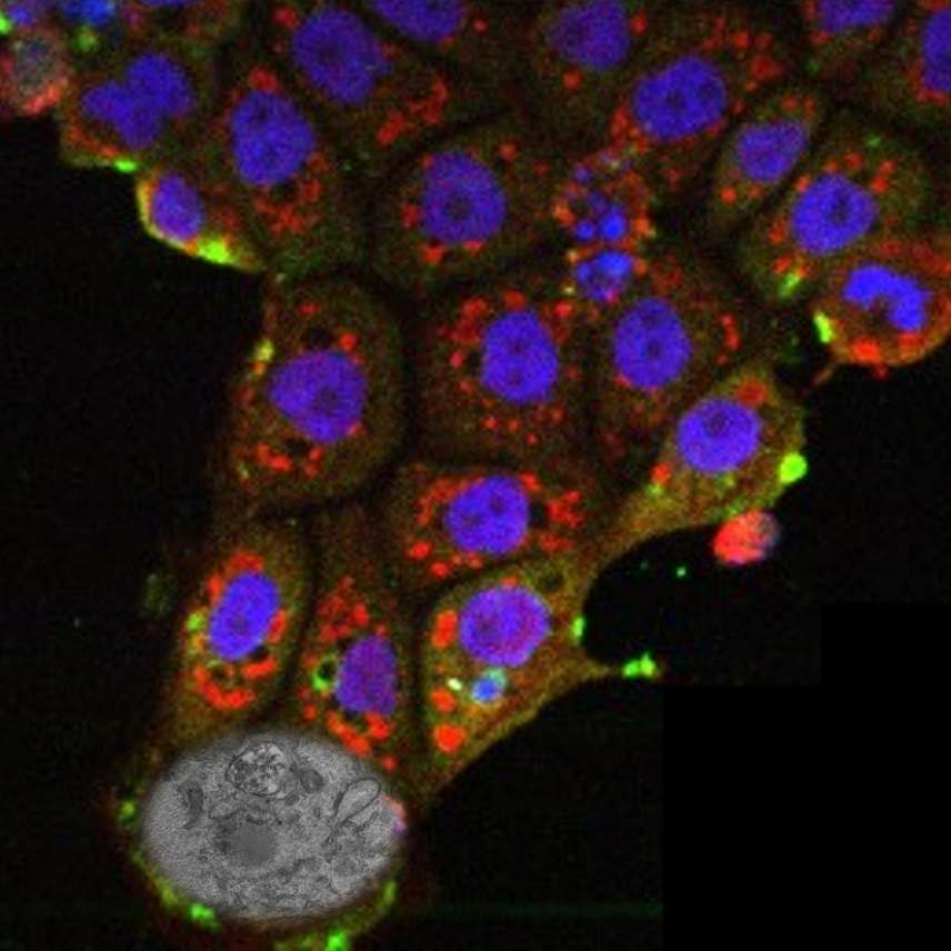 Cells arranged in a triangle shape. The organelles are visible in the bottom cell, which is an EM image.