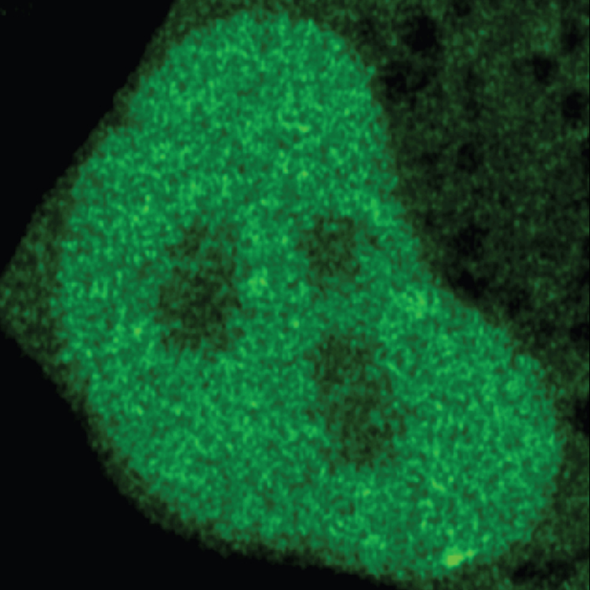 AMicrograph of a green shape, with three large darker areas in the middle