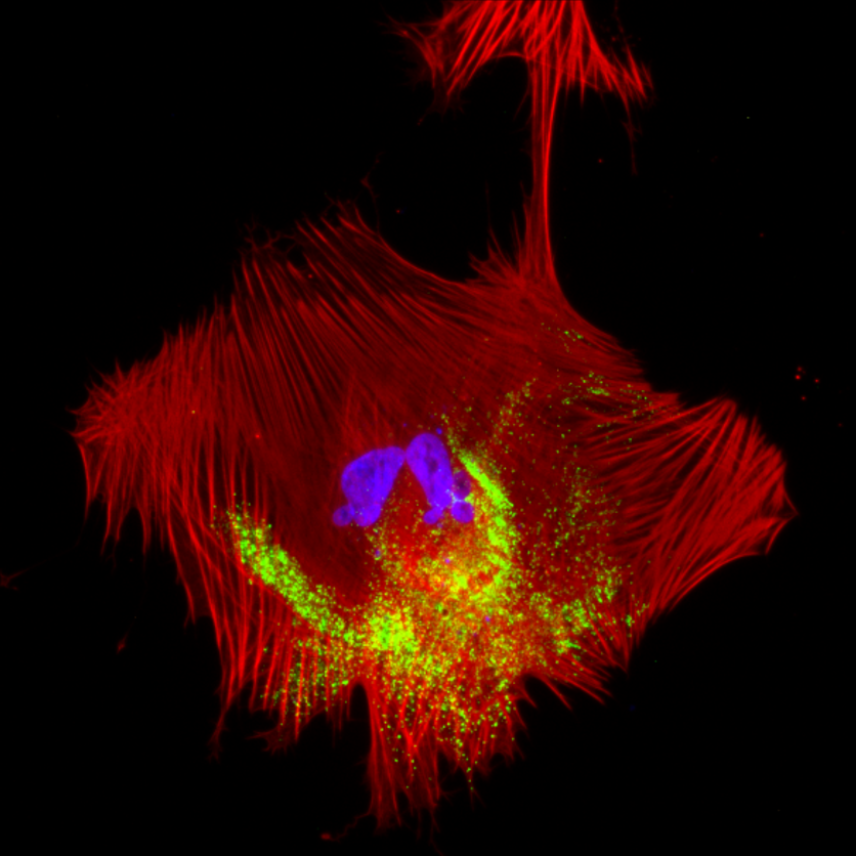 A cell in red, with sites of viral genome replication are in green.