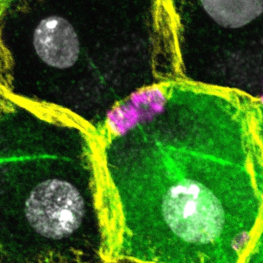 Micrograph: hexagonal cells with yellow outlines and gray centers