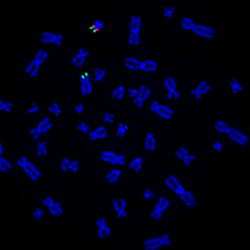 Micrograph with many blue X shaped chromosomes
