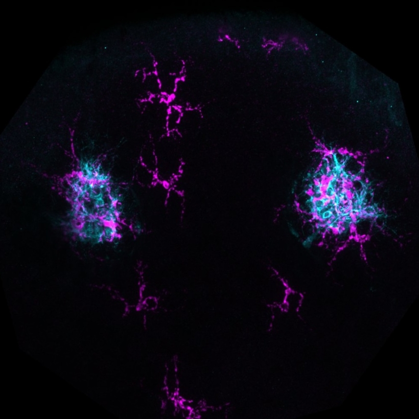 Micrograph with two spherical blobs of neurons and some neurons in between